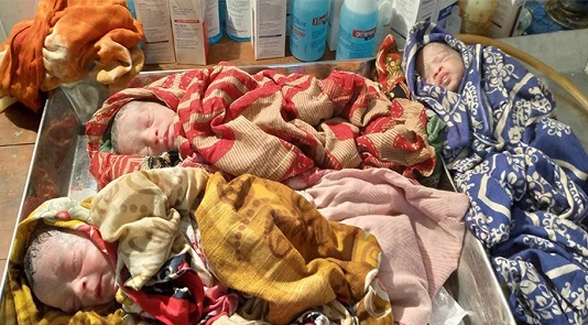 পাইকগাছায়  একসাথে ৩ কন্যা সন্তানের জন্ম দিলেন গৃহবধূ