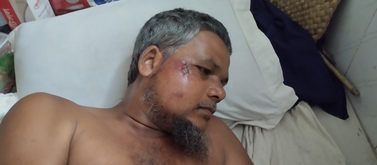 বরগুনায় তুচ্ছ ঘটনায় প্রতিপক্ষের হামলায় ৪ জন আহত,লুটপাটের অভিযোগ