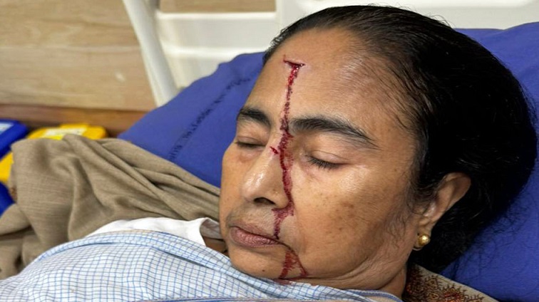 পশ্চিমবঙ্গের মুখ্যমন্ত্রী মমতা ব্যানার্জি মাথায় চোট পেয়ে গুরুতর আহত