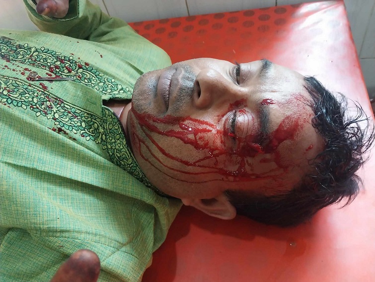 সখীপুরে সাংবাদিকের মাথা ফাটালেন আওয়ামীলীগ নেতা 