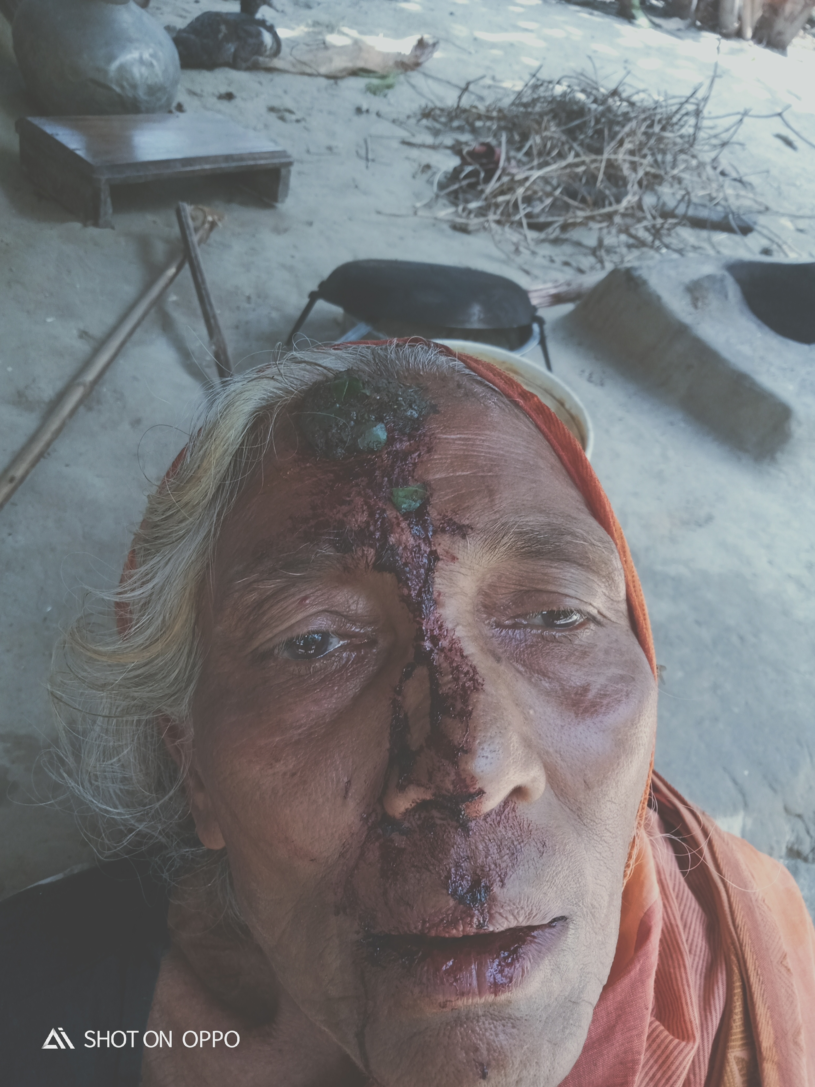 পাইকগাছায় জায়গা জমির বিরোধ কে কেন্দ্র করে হামলা ও মারপিটের ঘটনায় আহত ১০